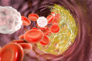 microspheres drug delivery
