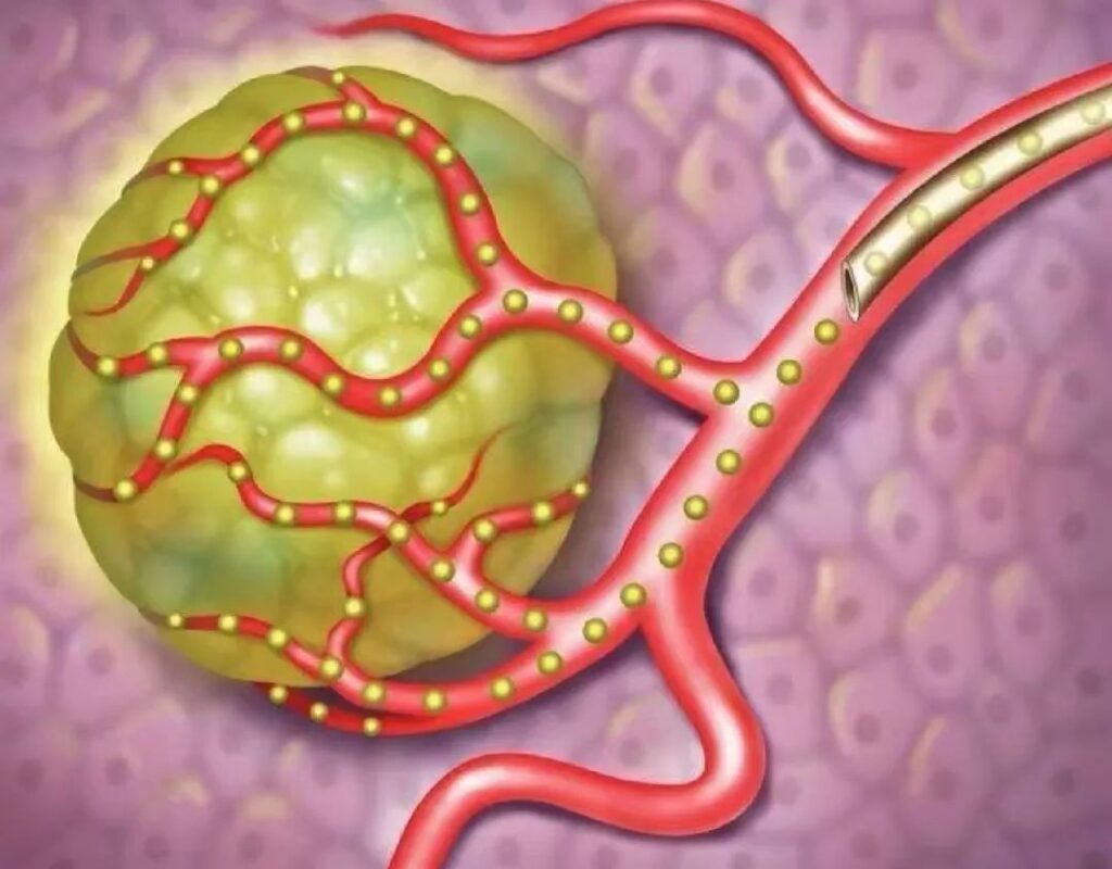 Microspheres Drug Delivery Systems